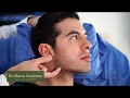 Masculinización facial con Ellanse (video corto)