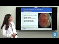 Eye Cancer Surgery: Part III | Tara McCannel, MD | UCLAMDChat