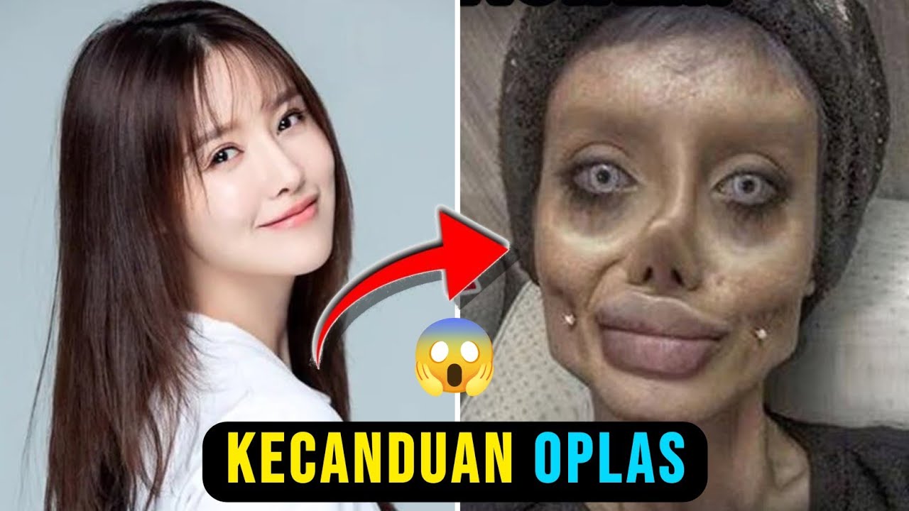 Nasib TRAGIS... 7 Artis Gagal OPLAS, Dari Konoha Paling Parah Akibat Tak Bersyukur Pemberian Tuhan