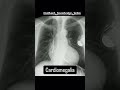 #knowledge #learning #science #students #lungs #body