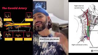 Using the microconvex probe for ICA