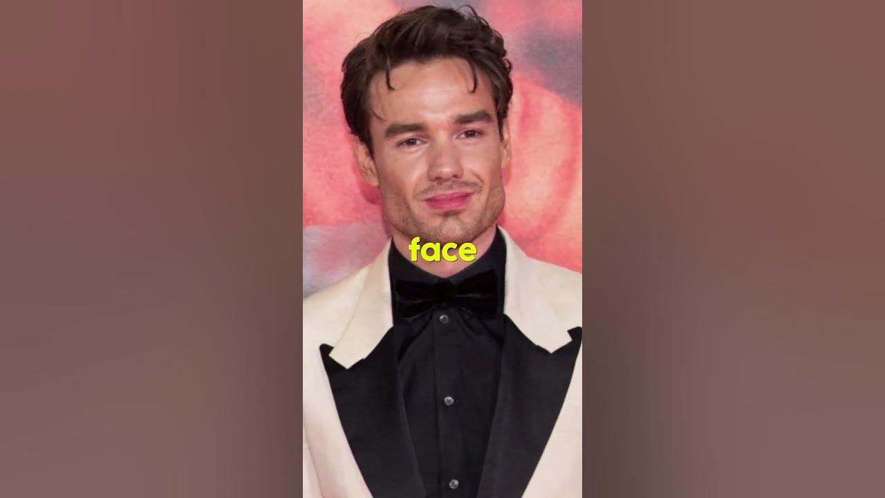 did-liam-payne-get-plastic-surgery-youtube