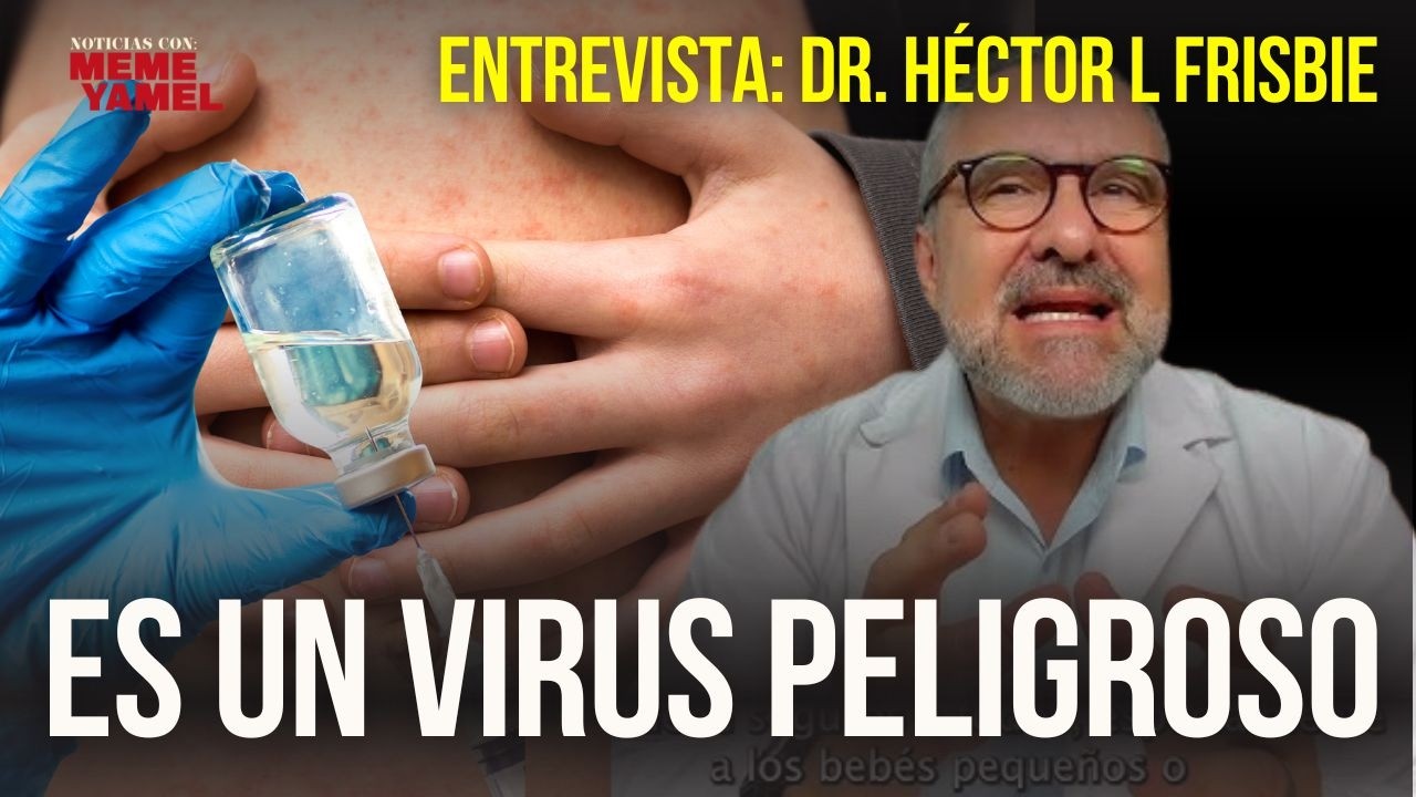 ⁣Mitos y realidades del SARAMPIÓN: esto es lo que NO te dicen los medios
