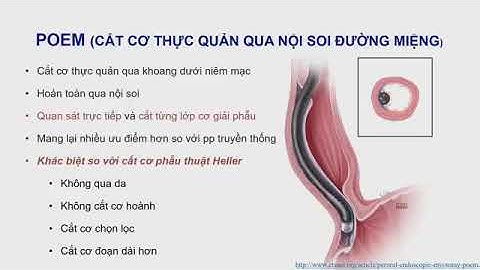 Phương pháp cắt cơ thực quản qua nội soi đường miệng điều trị co thắt tâm vị