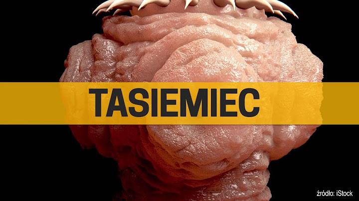 Te pasożyty mogą doprowadzić do śmierci!