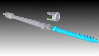 Degen Medical:F1 MPS Modular Pedicle Screw System
