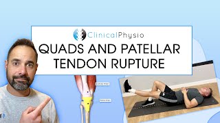 Quadriceps And Patella Tendon Rupture | Expert Physio Review