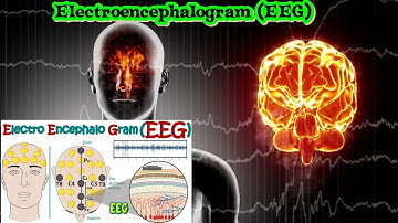 Electroencephalography (EEG) | How Electroencephalogram test works | What conditions can EEG diagnos