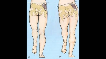 Running Form Friday 2.0 - Tim H.