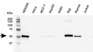 Quick Tips: Selecting a Primary Antibody to Get the Best Results in Western Blotting