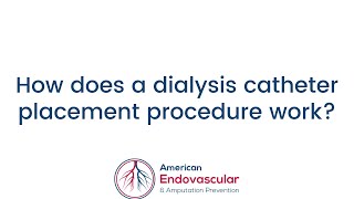 How does a dialysis catheter placement procedure work?