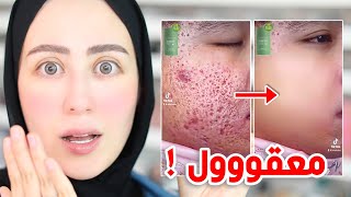 جربت الكريم السحري !! يزيل كل عيوب البشره بدقايق فقط !! 😱 || شهد ناصر 🌸