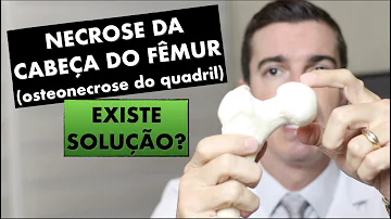 Como aliviar dor de osteonecrose?