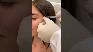 Aplicação de botox! #dermatologia #medico #luizporto #botox #botoxnatural #saúdeebeleza #estética