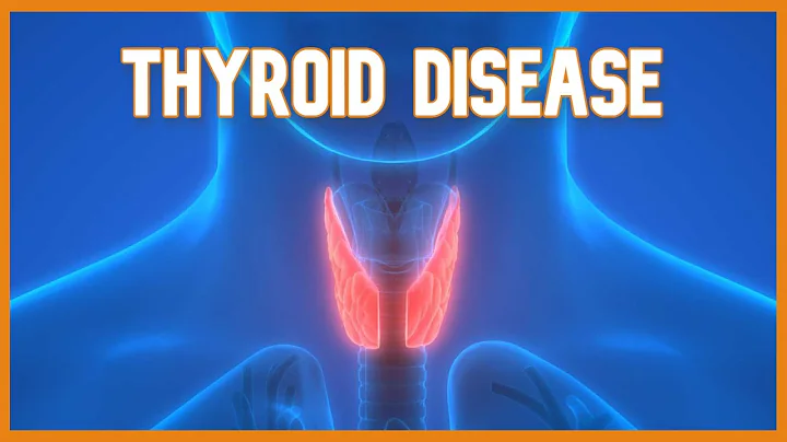 Thyroid Disease (Hyperthyroidism vs. Hypothyroidism)