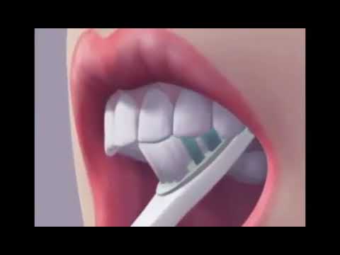 როგორ გავიხეხოთ სწორად კბილები