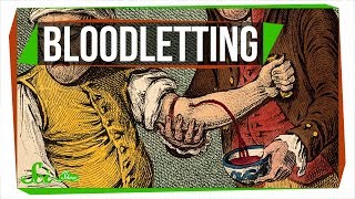 Why Do Some Doctors Still Use Bloodletting? Why Do Some Doctors Still Use Bloodletting?
