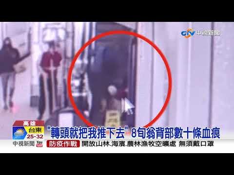 8旬夫婦遭怪男"推下手扶梯" 家屬怒:挖眼案翻版│中視新聞 20211005