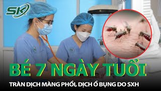 Điều Trị Khỏi Bệnh Nhi 7 Ngày Tuổi Dịch Ổ Bụng Do Sốt Xuất Huyết |SKĐS