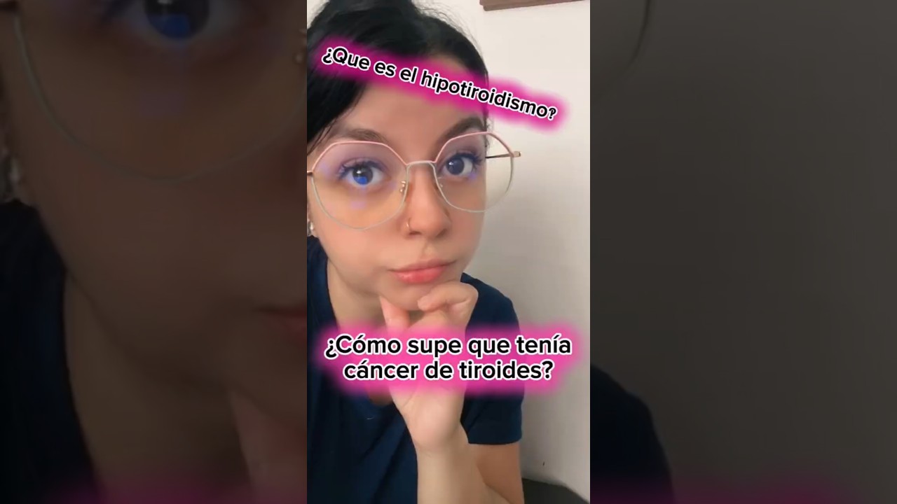 ¿Que es el hipotiroidismo, y como me di cuenta que tenía cáncer de tiroides? 