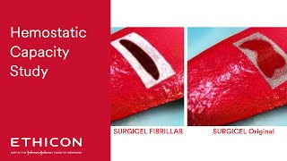 Hemostatic Efficacy: SURGICEL FIBRILLAR vs SURGICEL Original | Ethicon