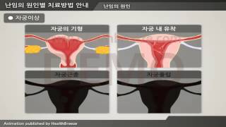 [시연용] c0063aako 난임의 원인별 치료방법 안내