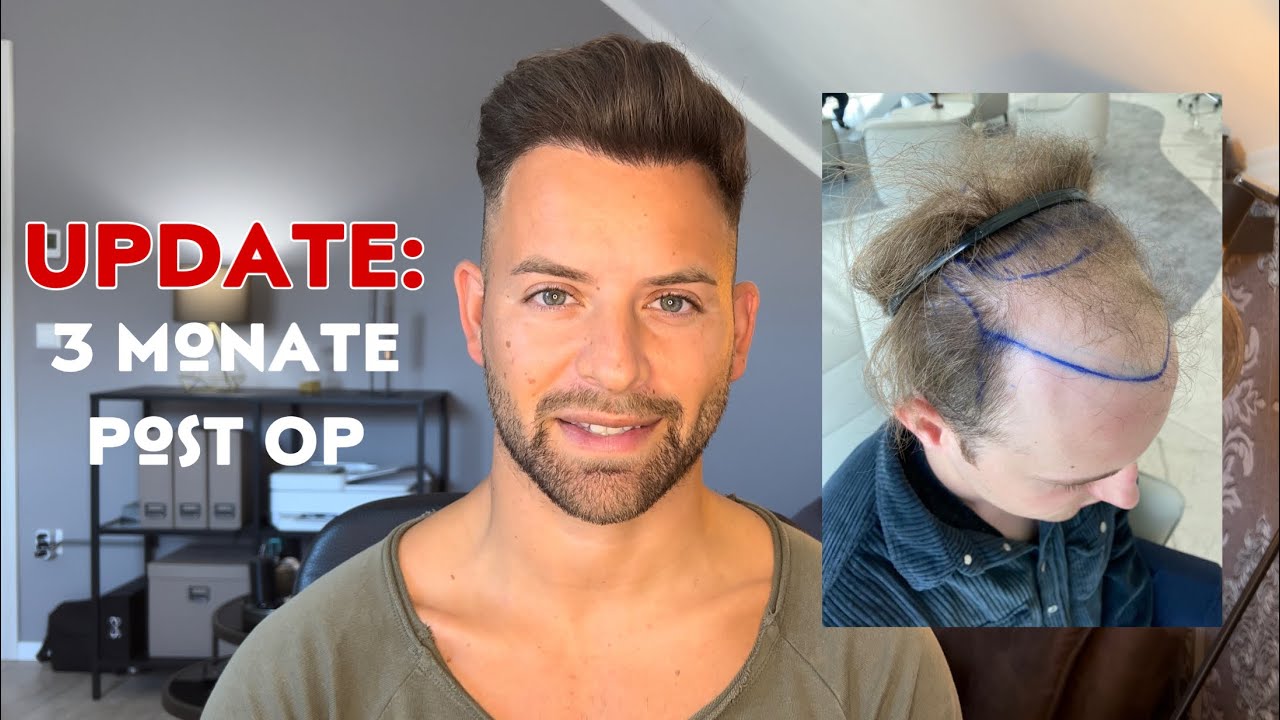 Hündin Fiept 2 Monate Nach Läufigkeit STATUS 3 MONATE NACH HAARTRANSPLANTATION - Patientenbegleitung Elithair