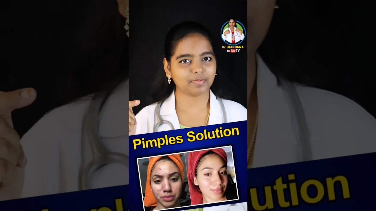 pimples Best Ointment 
