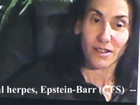 Recall Natural Laws - Barb Has CURED Herpes - Cold Sores & Epstein-Barr