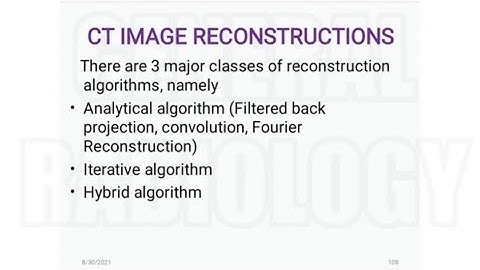 Physics: CT Image Reconstruction ( simple back projection, Iterative Reconstruction, FBP, FT, etc).