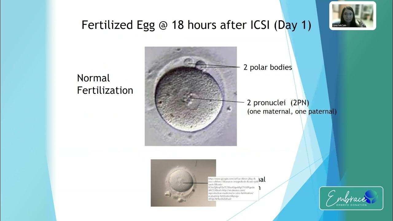 How are IVF embryos created? Embryologist Gina McCain walks through