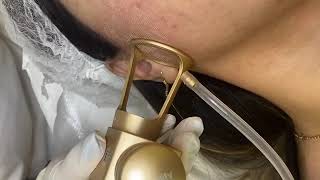 Laser Beauty Clinic - Fraksion Lazer