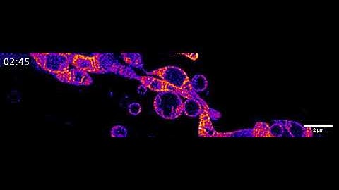 Time-lapse STED imaging of the inter-mitochondrial fusion.
