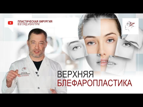 Видео: Что такое верхняя блефаропластика?