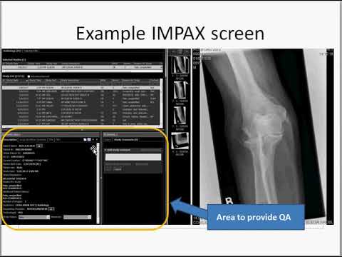 How to provide QA to techs  through Impax (for radiographs)