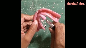 dental custom tray trimming | bds | prosthodontics| Dental material | dental doc| dental doctor