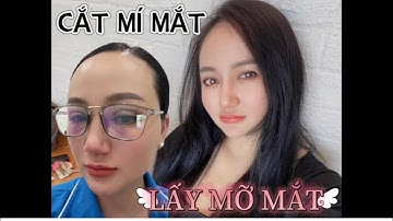 #300 "PTTM #3"  CẮT MÍ MẮT & LẤY MỠ THỪA MÍ MẮT Ở ĐÂU ĐẸP ? BÁC SĨ GIỎI UY TÍN TẠI SAIGON .