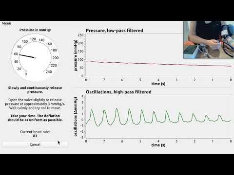 Video: Impulsu Oscilometrija Identificē Perifēro Elpceļu Disfunkciju Bērniem Ar Adenozīna Deamināzes Deficītu