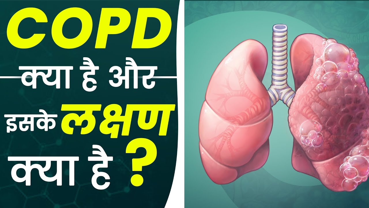 COPD (सीओपीडी) Kya Hai? Chronic Bronchitis (COPD) Causes & Symptoms