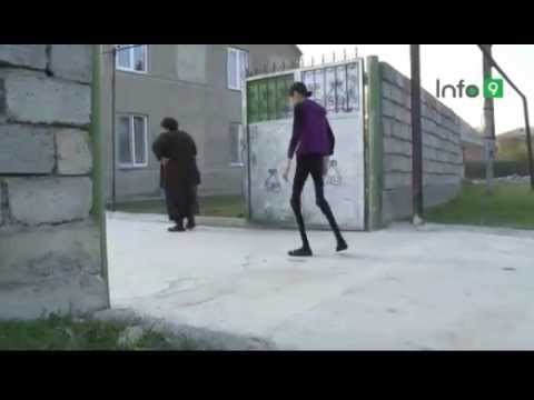 ანორექსიით დაავადებული 29 წლის ქართველი გოგო, რომელიც 22 კილოს იწონის