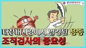 대장내시경에서 발견된 용종, 조직검사의 중요성