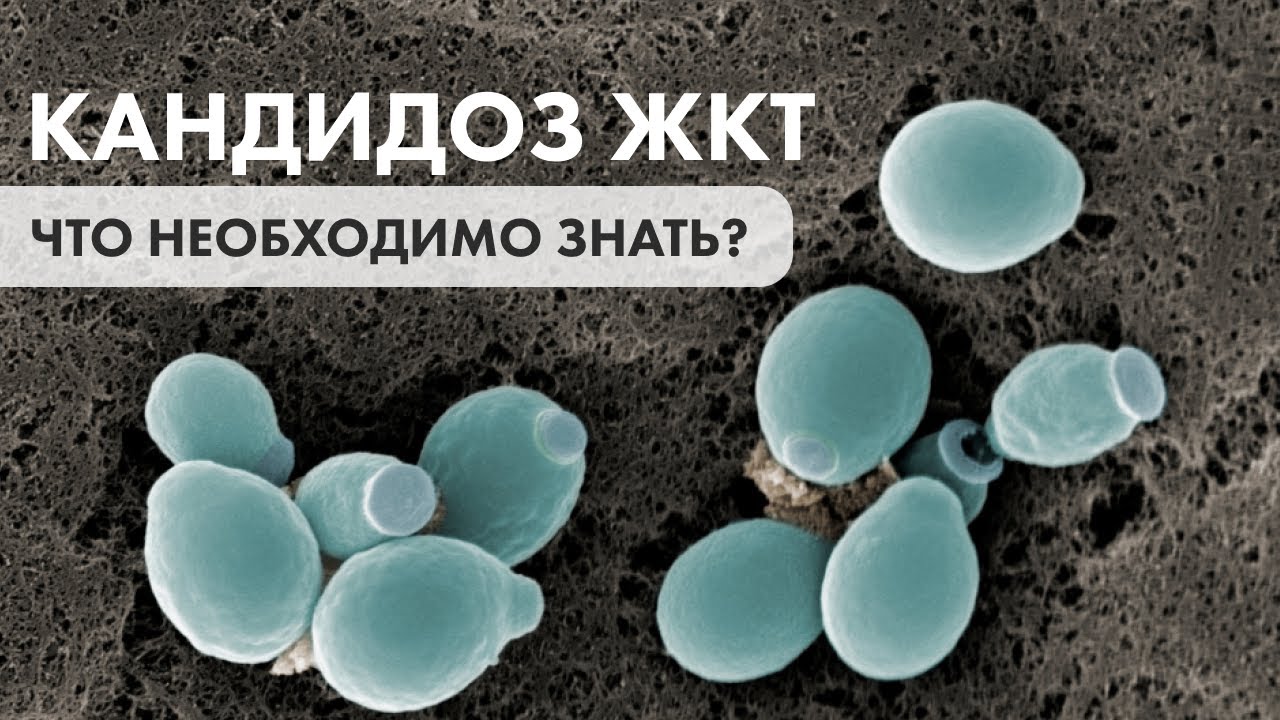 Кандидоз ЖКТ Запись прямого эфира - YouTube