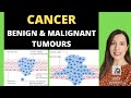 Cancer alevel biology benign and malignant tumours and how tumours develop