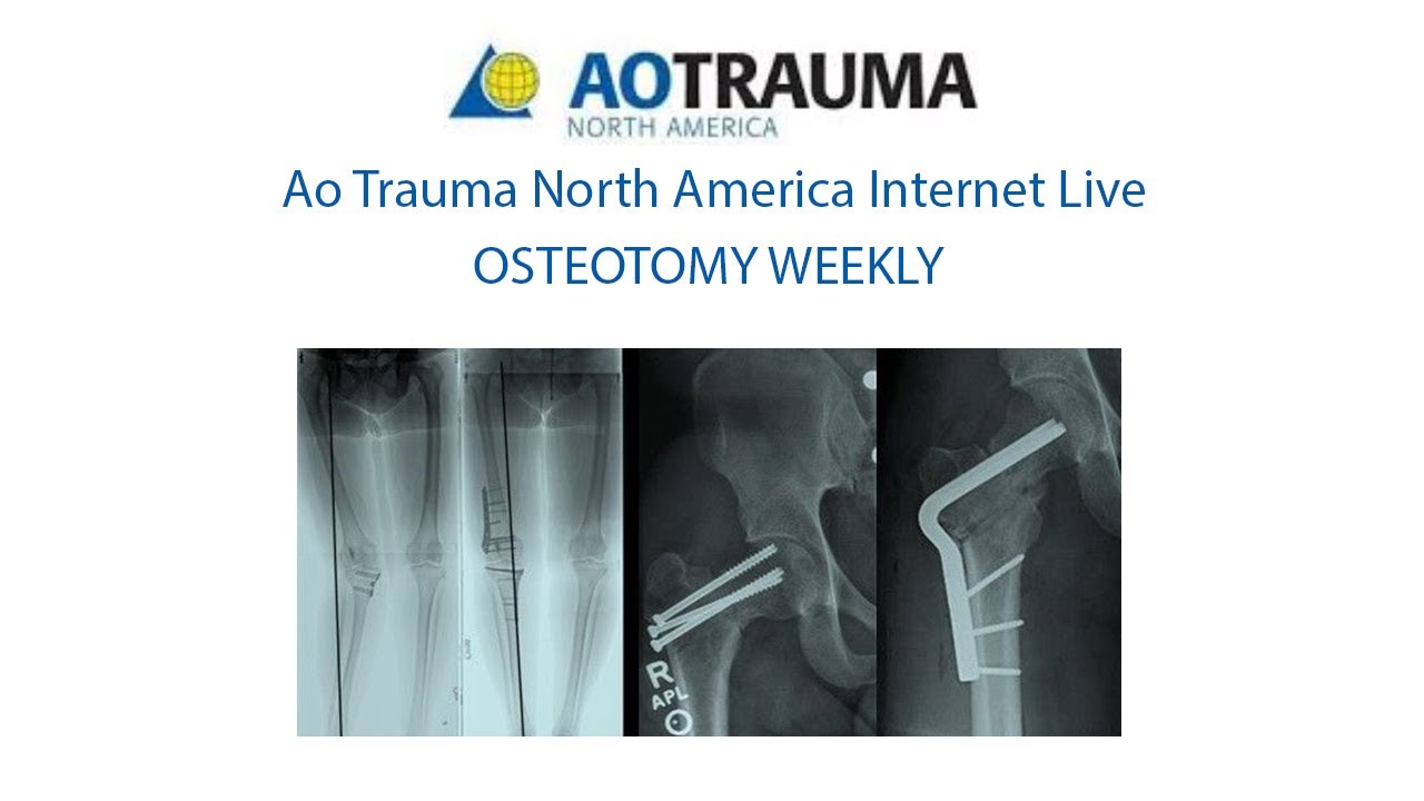 Osteotomy Week 7 May 30 Periarticular Osteotomies Around The Knee