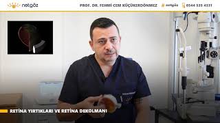 Prof. Dr. Fehmi Cem Küçükerdönmez - Retina Yırtığı, Retina Dekolmanı Resimi