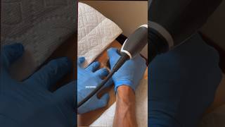 Live radial shockwave demonstration PT.1     #chiropractic #chiropractor #health #backpain #shock￼