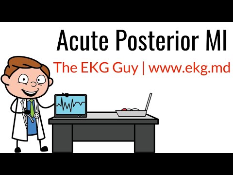 acute-posterior-mi-on-ekg-/-ecg-l-the-ekg-guy---www.ekg.md