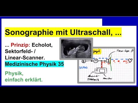 Sonographie mit Ultraschall, Prinzip: Echolot, Sektorfeld- / Linear ...