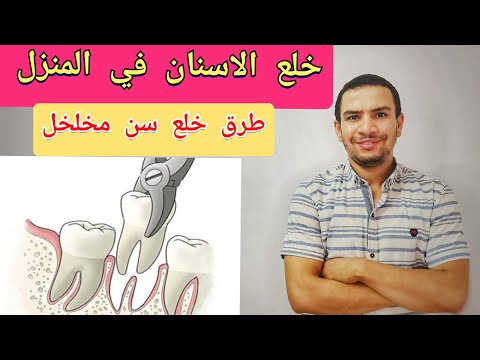 5 طرق لخلع الاسنان في المنزل بدون طبيب