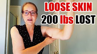 My LOOSE Skin After 200 lbs WEIGHT Loss | The Result of Weight Loss #ketotransformation